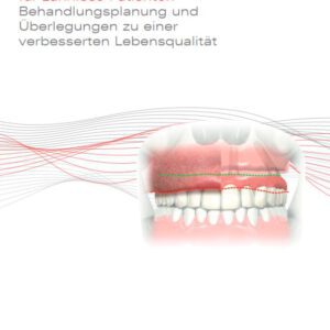 Versorgungskonzepte für zahnlose Patienten 13.1 [Digital]