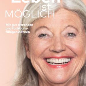 Patientenflyer "All-on-4" (20 Pkg)