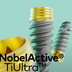 Nobel Active TiUltra Procedures Manual - Deutsch