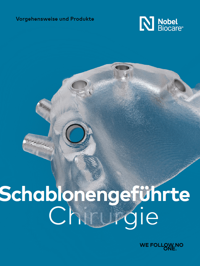 Guided Surgery Manual 21.1 DE