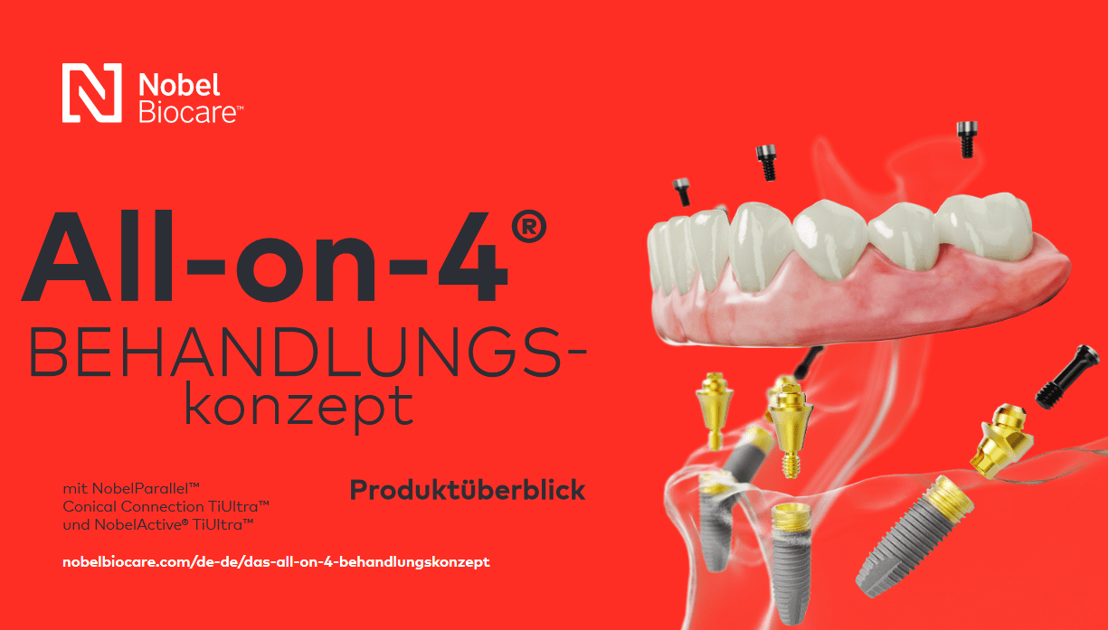 All-on-4 Behandlungskonzept
