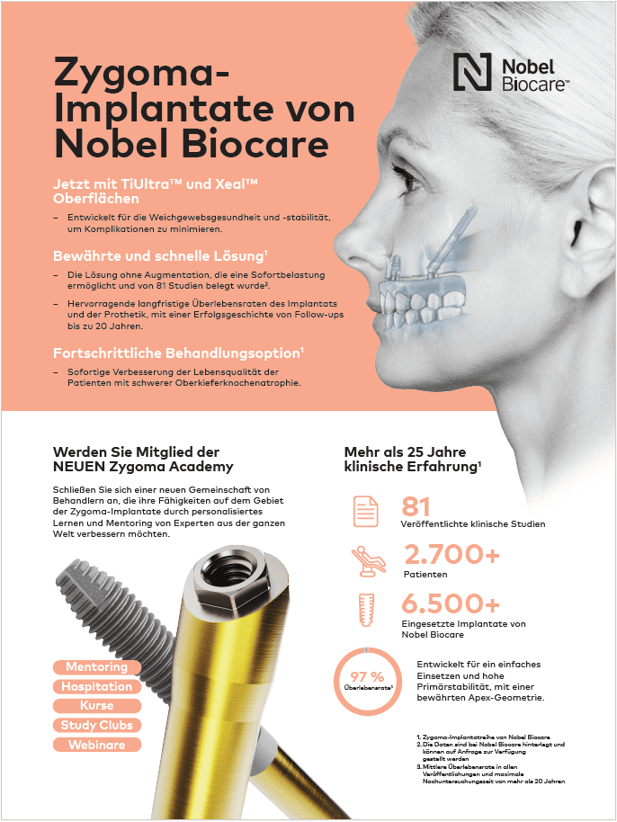 Zygoma solution overview_DE