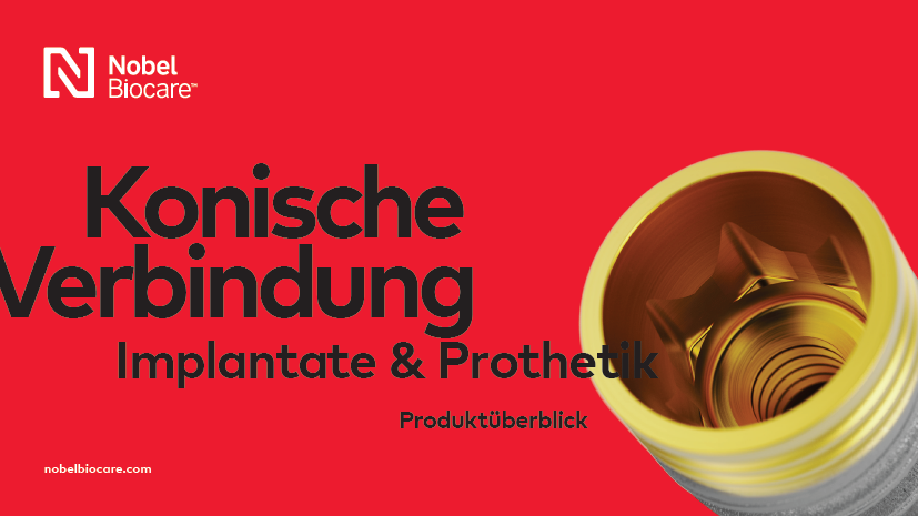 95428 Titelseite Konische Verbindung Implantate & Prothetik Produktüberblick DE 2602