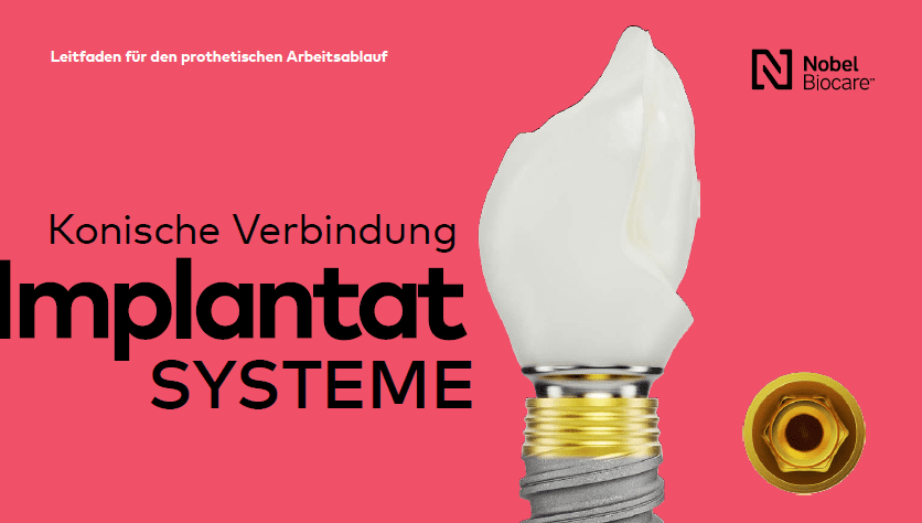 Konische Verbindung Implantatsysteme Leitfaden für den prothetischen Arbeitsablauf DE 2502