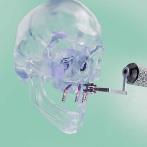 Kopf und Ständer für Portable X-Guide´s - Nur für DE