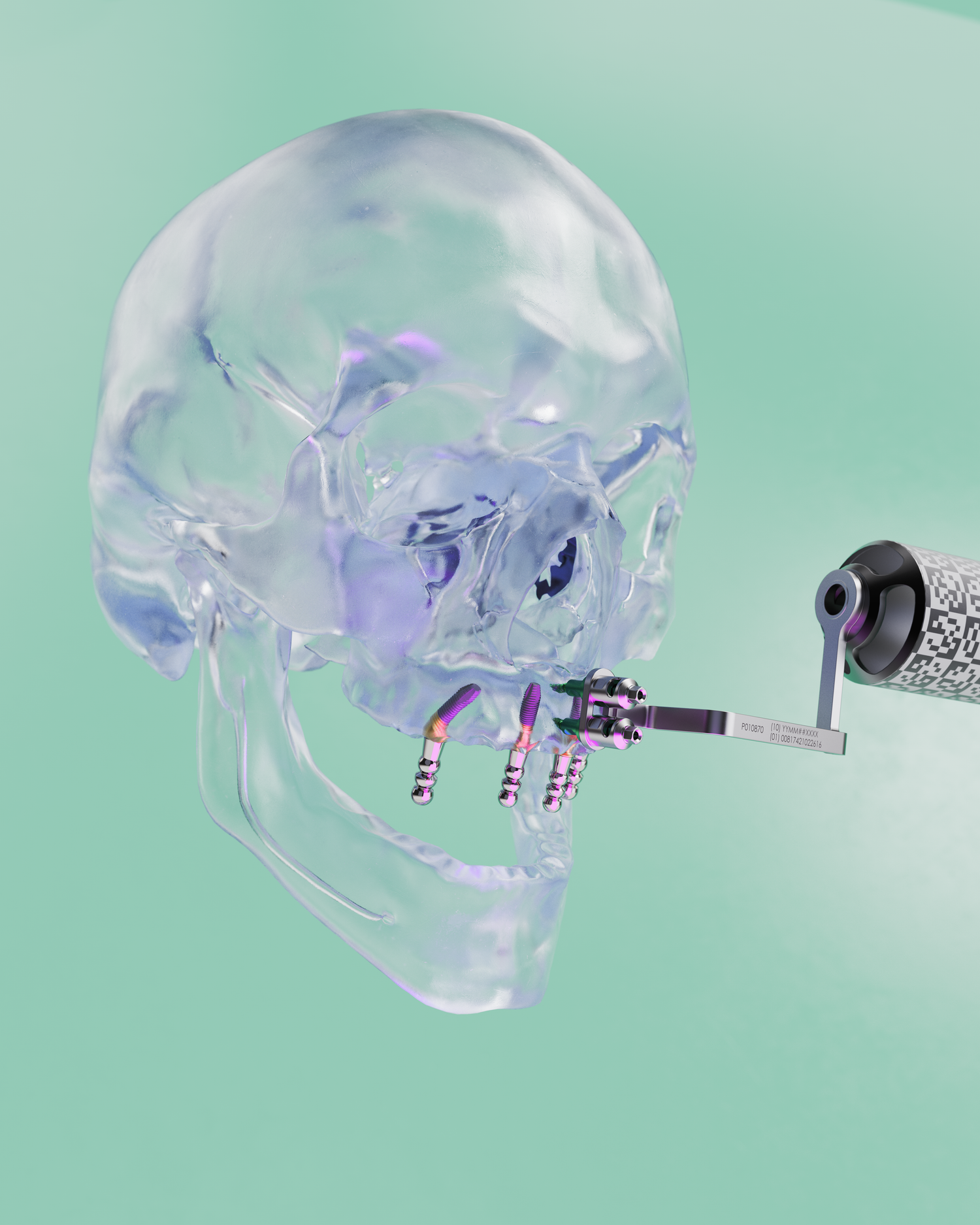 Kopf und Ständer für Portable X-Guide´s - Nur für DE