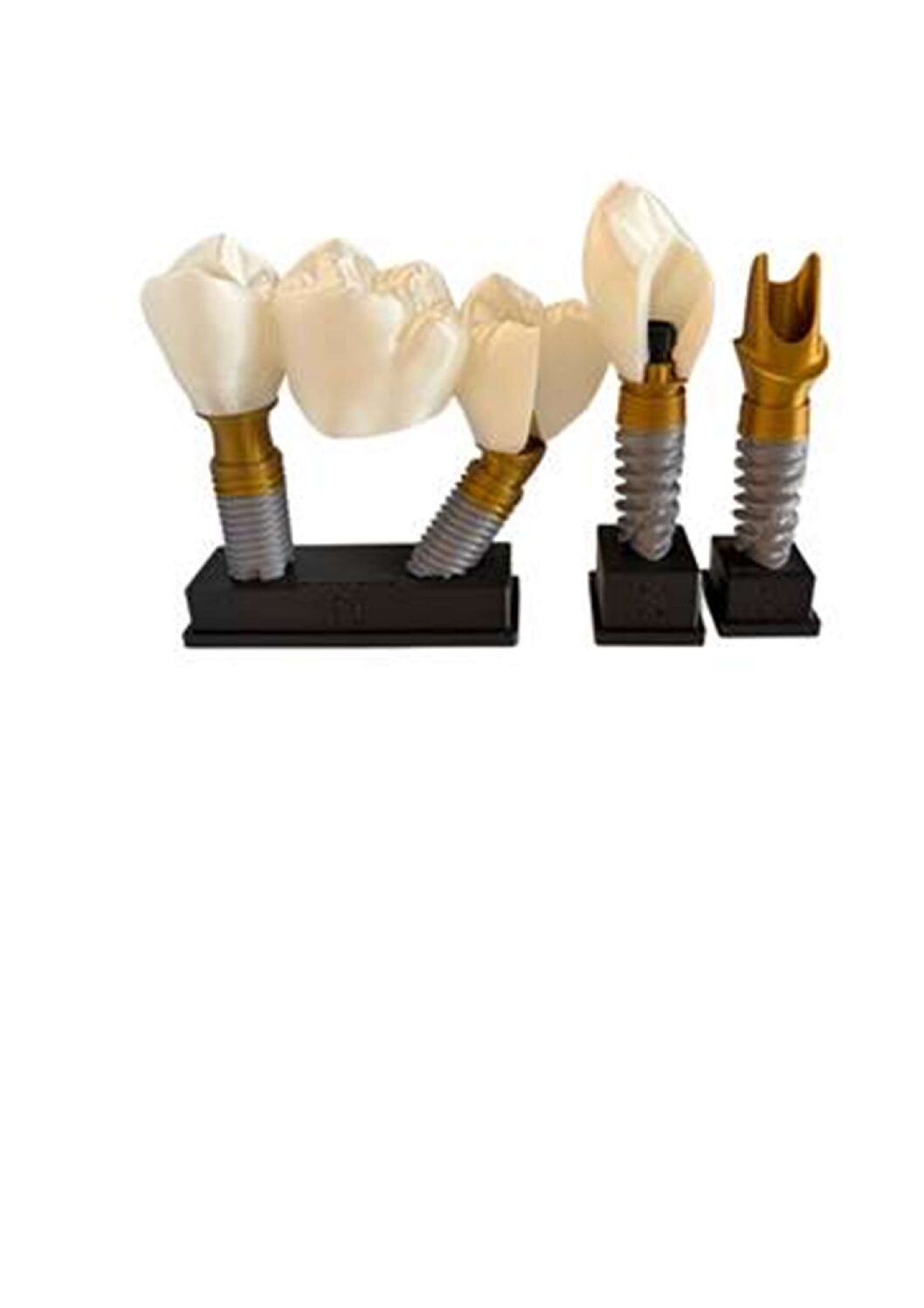 Printed King Size Dummy Procera Set