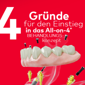 4 Gründe für den Einstieg in das All-on-4 Behandlungskonzept