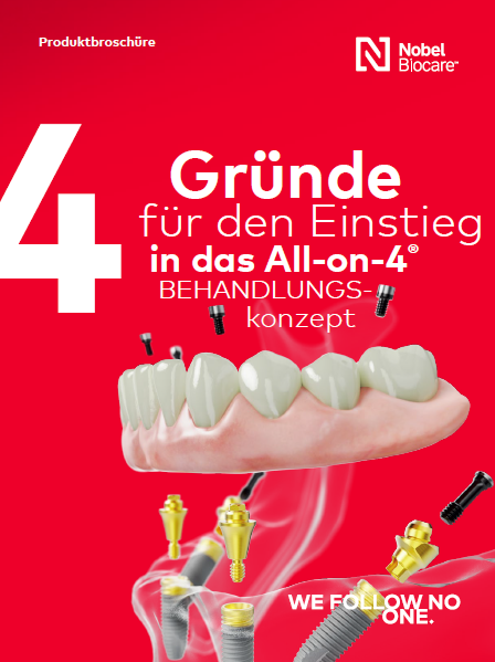 87528 Titelbild 4 Gründe für den Einstieg in das All-on-4 Behandlungskonzept